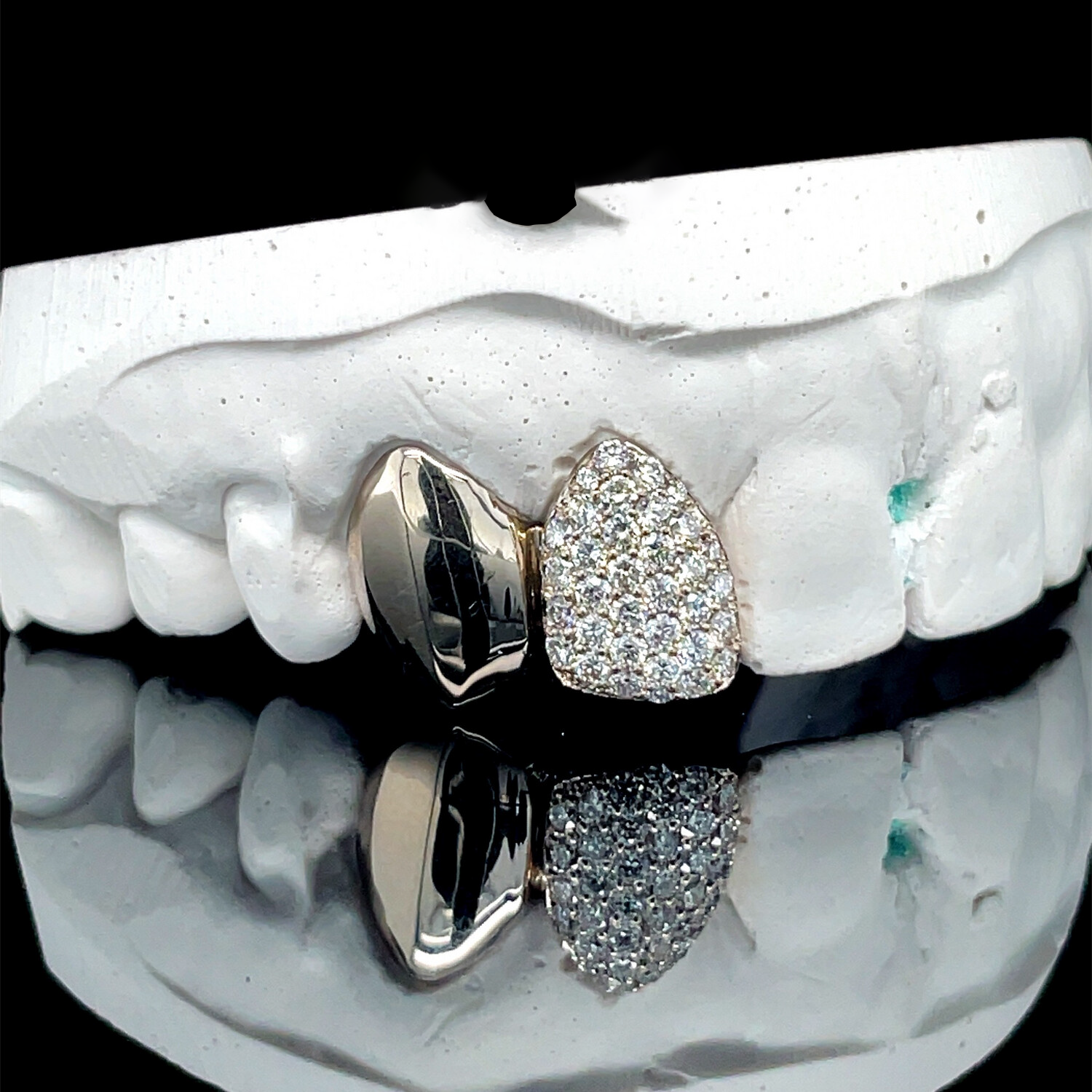 Single Iced & Plain Gold tooth