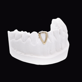 Gold Window Tooth