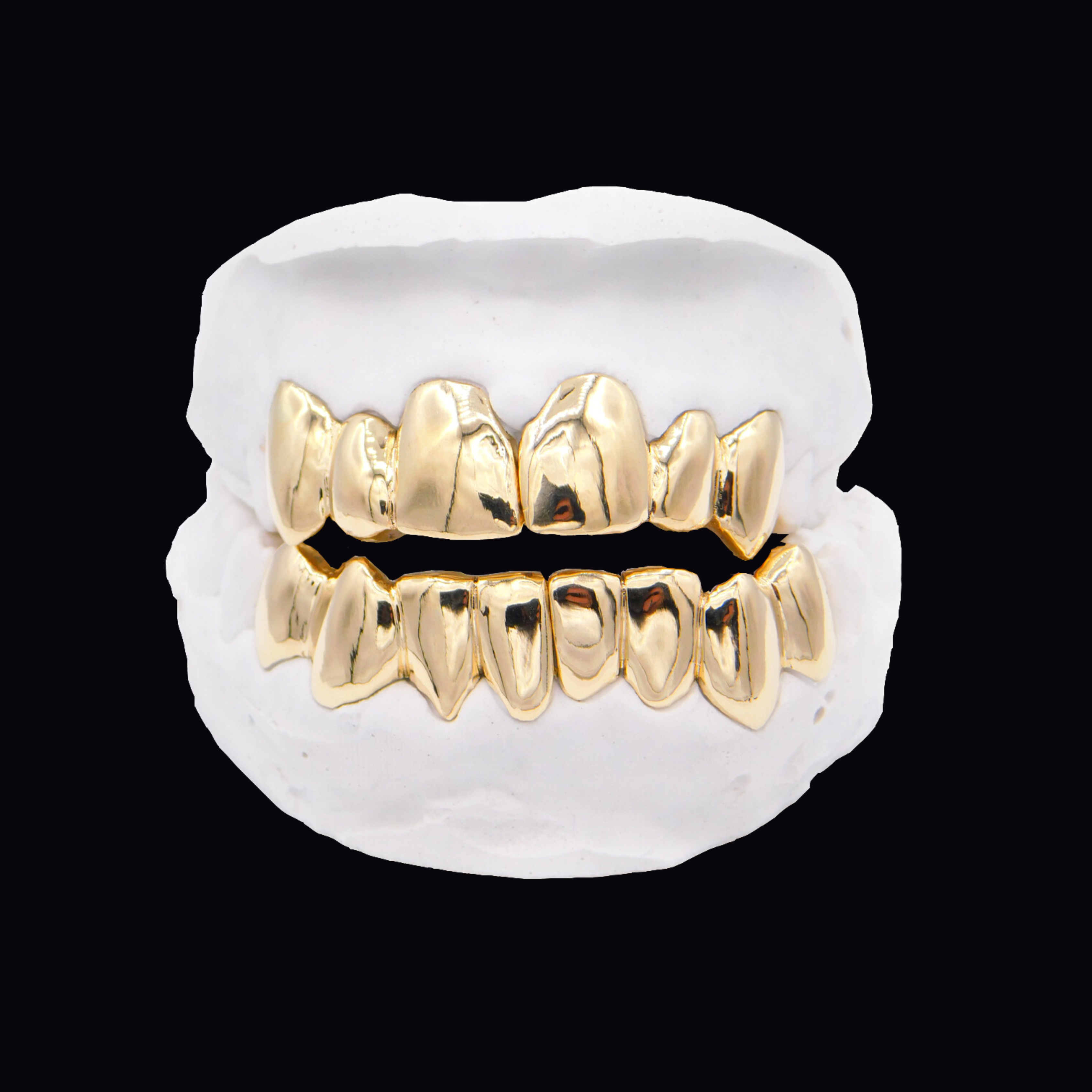 Upper & Lower Gold Grillz